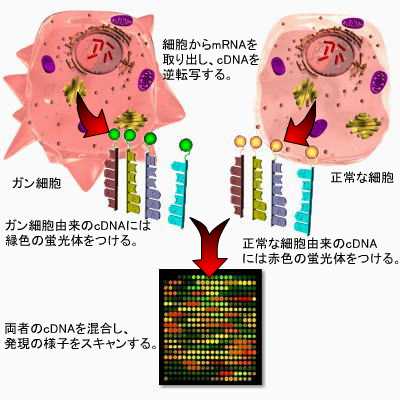 dnachip_cancer