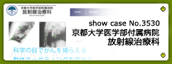 No.3530 京都大学医学部付属病院 放射線治療科